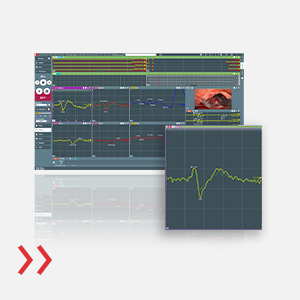 NeuroExplorer 8 - Next level NeuroExplorer Software for highest usability IONM