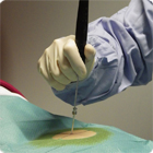 Application C3 CryoSystem